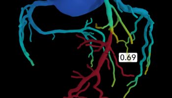 מהפכת הדופק: מצוינות קרדיווסקולרית מוגדרת מחדש