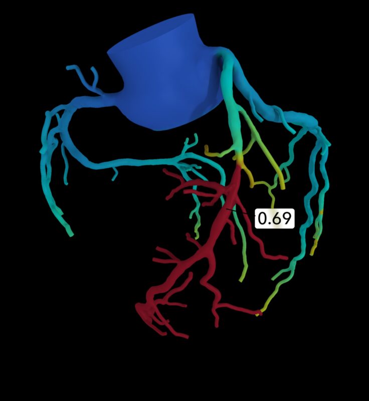 מהפכת הדופק: מצוינות קרדיווסקולרית מוגדרת מחדש